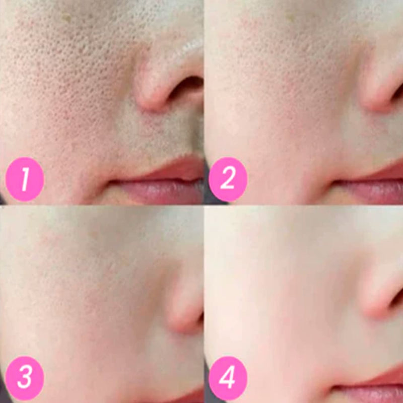 Creme Mágico FaceSlift ® - Compre 1 Leve 3 - Site Oficial de Vendas